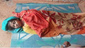 Read more about the article जहरिला सांप के काटने से यूपी की मौत
