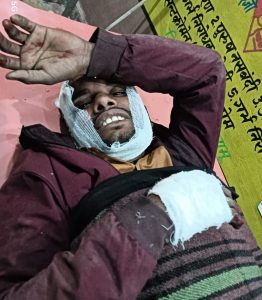 Read more about the article कार और बाइक की टक्कर में बाइक सवार दो गंभीर